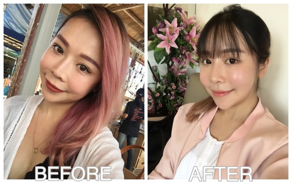 phẫu thuật thẩm mỹ phẫu thuật thẩm mỹ