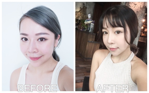 phẫu thuật thẩm mỹ phẫu thuật thẩm mỹ