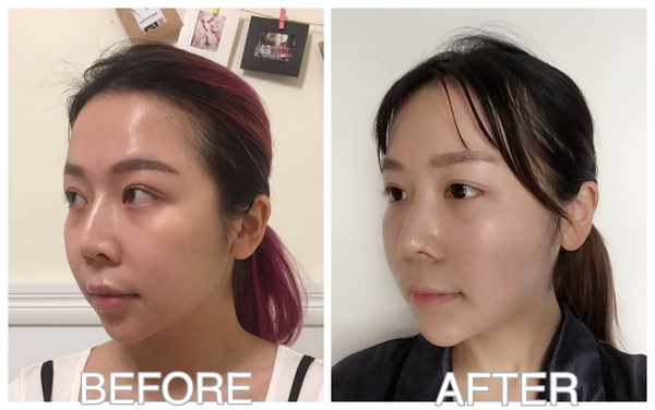 phẫu thuật thẩm mỹ phẫu thuật thẩm mỹ