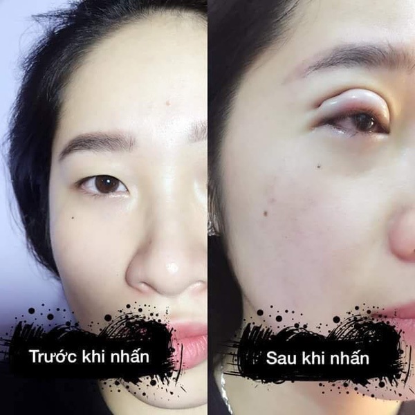 phẫu thuật thẩm mỹ 