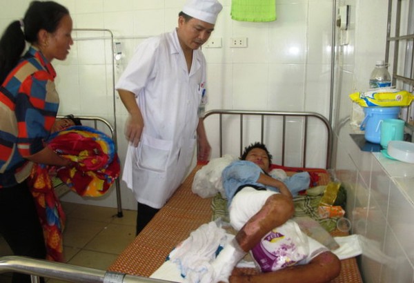 B&eacute; trai bỏng nặng nghi do mẹ x&ocirc; v&agrave;o đống lửa 1