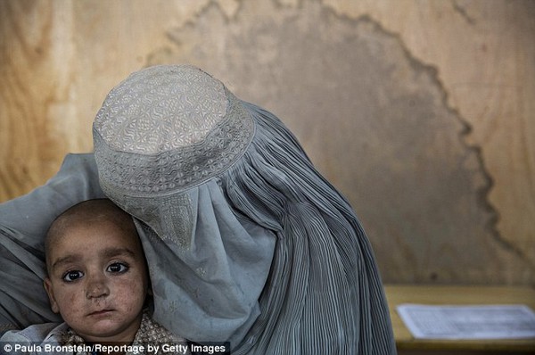 Hình ảnh gây sốc về những đứa trẻ đói ăn, suy dinh dưỡng ở Afghanistan  10