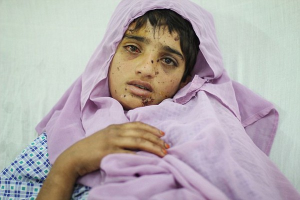 Hình ảnh gây sốc về những đứa trẻ đói ăn, suy dinh dưỡng ở Afghanistan  4