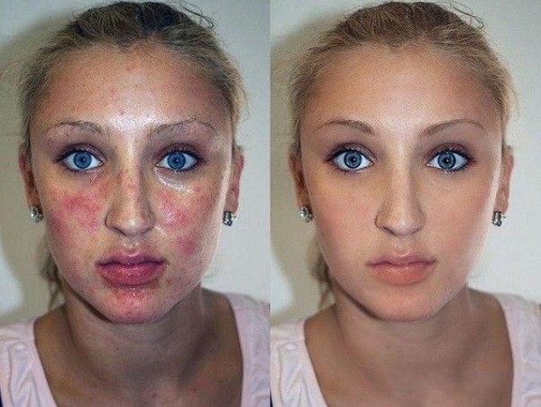 Hình ảnh gây sốc trước và sau khi dùng phần mềm chỉnh sửa ảnh
