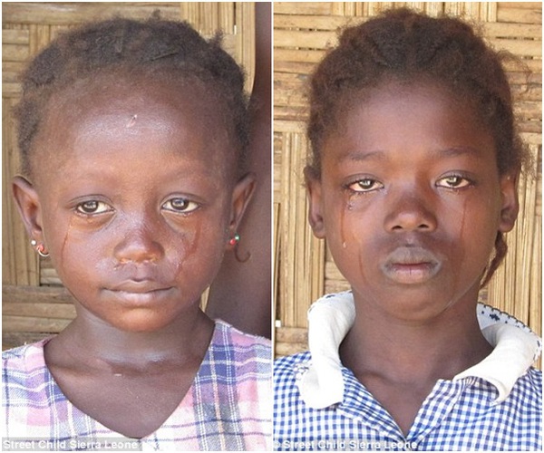 Nước mắt của những đứa trẻ mồ côi đói khát giữa vùng dịch Ebola