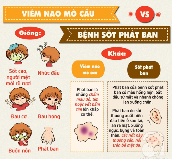 phân biệt bệnh viêm não mô cầu