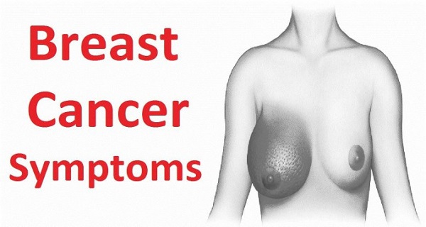 phòng tránh ung thư vú