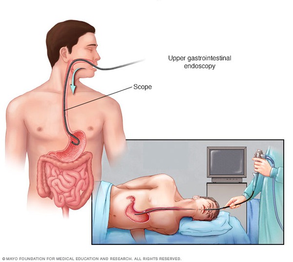 hình thức xét nghiệm