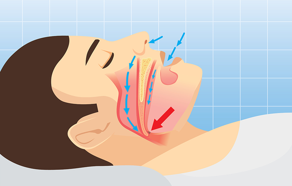 bệnh không có dấu hiệu cụ thể