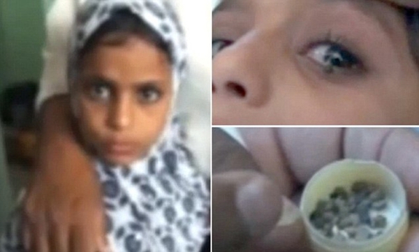 Cô bé 12 tuổi khóc ra đá ở Yemen 2
