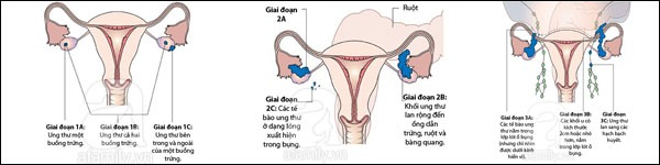 2 cách tự kiểm tra những bất thường ở cơ quan sinh sản 2