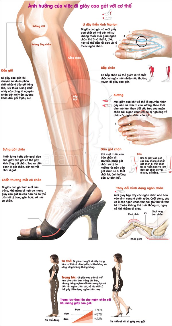 Những nguy hiểm cho đôi chân và vóc dáng do đi giày cao gót 1