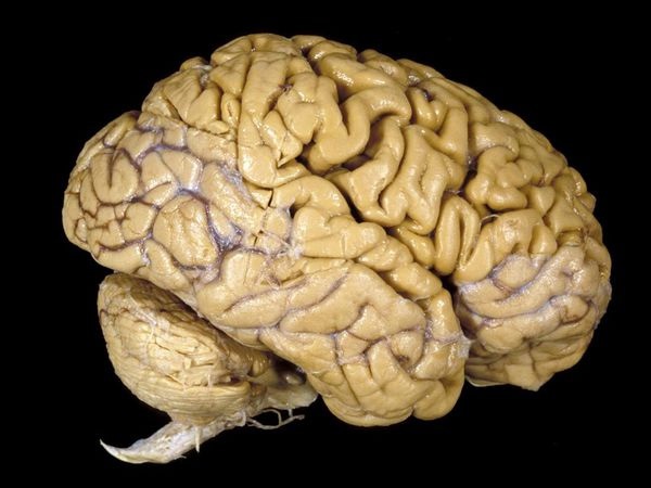 Những hình ảnh đặc biệt về bộ não con người 1