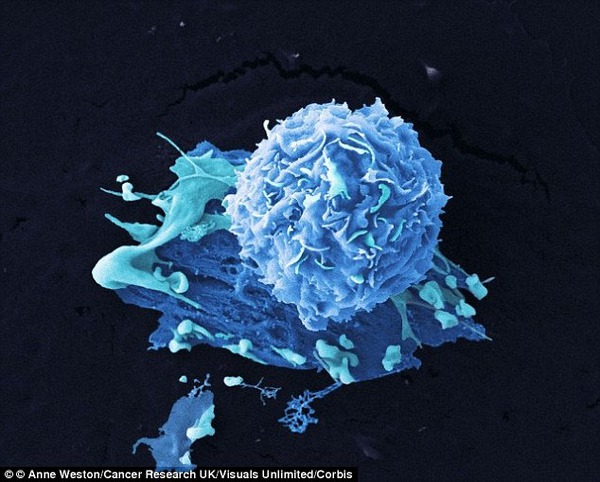 Mối liên hệ giữa đậu nành và nguy cơ phát triển ung thư vú 1