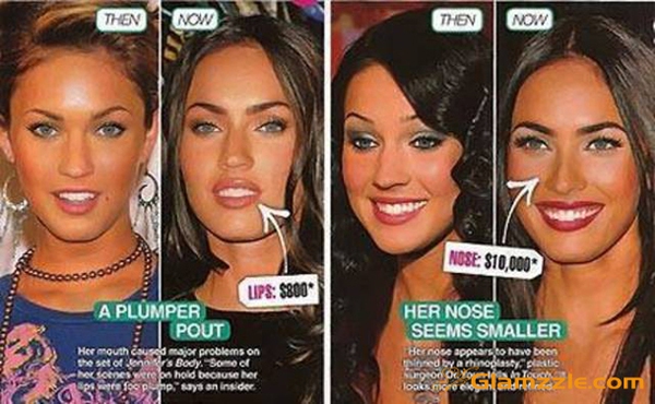 Megan Fox và công cuộc đại tu nhan sắc bằng 