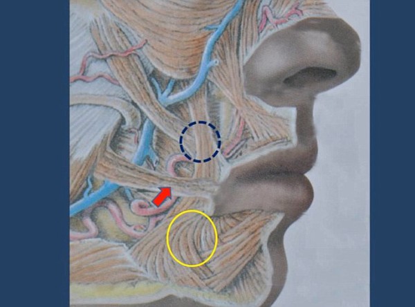 PTTM miệng cười... cánh cung - Trào lưu làm đẹp lạ lùng xứ Hàn 2