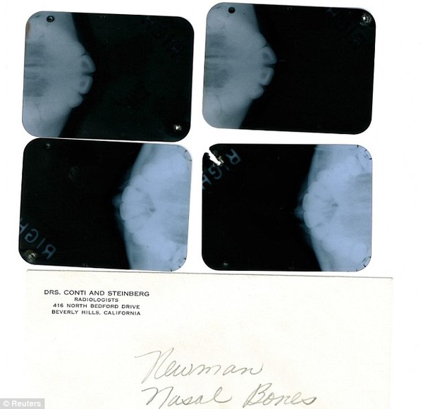 Lộ phim chụp X quang cho thấy Marilyn Monroe đã từng phẫu thuật thẩm mỹ 4