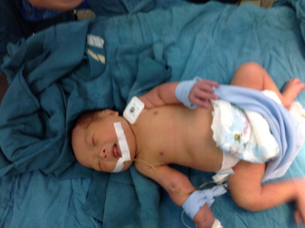 Chuyện kỳ diệu về bé sơ sinh chờ chết tình cờ được cứu ở Phú Yên 3