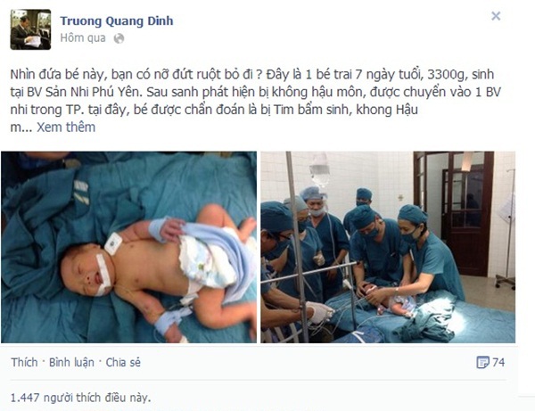 Chuyện kỳ diệu về bé sơ sinh chờ chết tình cờ được cứu ở Phú Yên 1