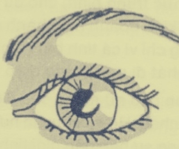 Hiện tượng vôi hóa mắt là gì? | Báo Dân trí