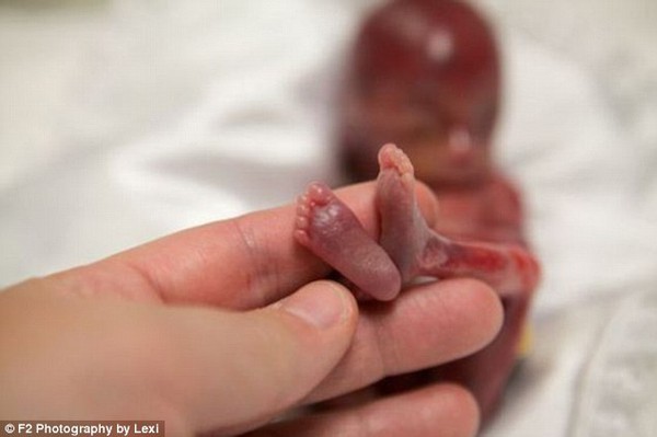 Xúc động trước hình ảnh em bé được sinh ra khi mới 19 tuần tuổi 5