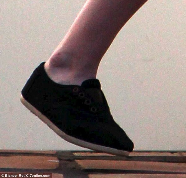 Cận cảnh bàn chân bị thương của Kristen Stewart 2