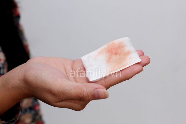 Tẩy trang Lanc&ocirc;me Galat&eacute;is Douceux sử dụng được cho cả da mặt v&agrave; mắt 7