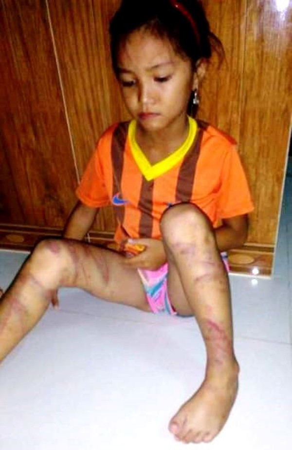 bé gái bị bạo hành