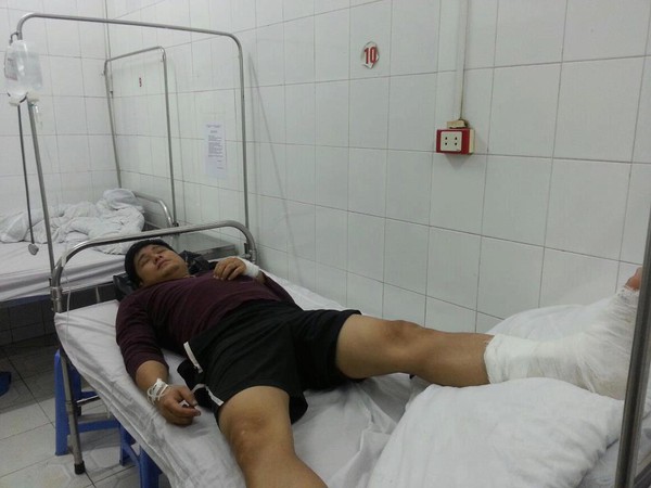 Minh Tiệp nhập viện v&igrave; ng&atilde; ngựa 1