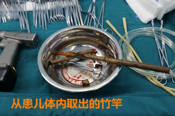 Em be bi tai nan 3