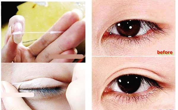 5 dụng cụ thẩm mỹ cấp tốc không mổ xẻ được phái đẹp lăng xê rầm rộ 11 5 dụng cụ thẩm mỹ cấp tốc không mổ xẻ được phái đẹp lăng xê rầm rộ 11