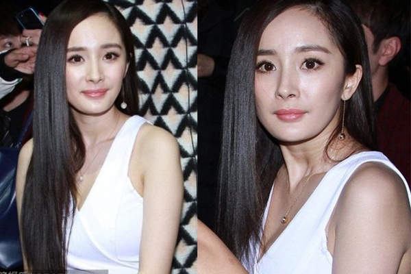 Loạt sao Hoa ngữ bị soi mặt cứng đờ, sưng phù vì tiêm botox/filler 6 Loạt sao Hoa ngữ bị soi mặt cứng đờ, sưng phù vì tiêm botox/filler 6