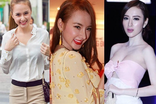 Agela phương Trinh sửa mũi Agela phương Trinh sửa mũi