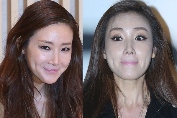 Những khuôn mặt méo mó gây sốc của loạt kiều nữ xứ Hàn  5