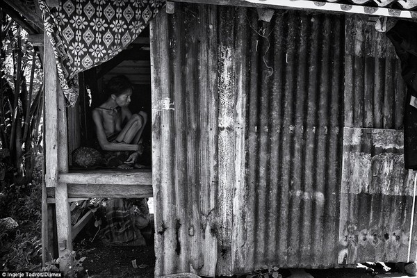 Ám ảnh cuộc sống địa ngục của những bệnh nhân tâm thần ở Bali 11