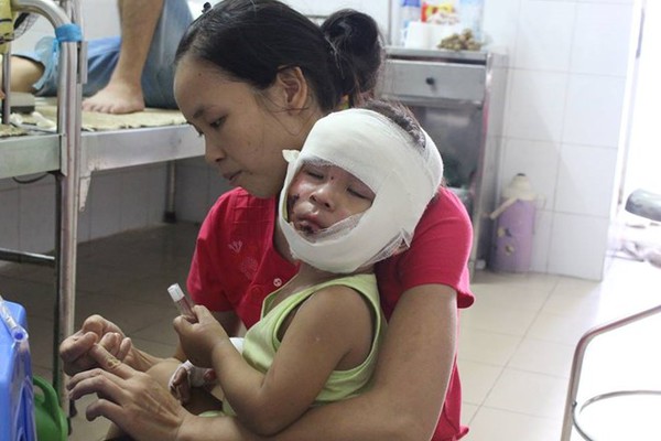 C&ocirc; nướng mực, ba ch&aacute;u th&agrave;nh ngọn đuốc