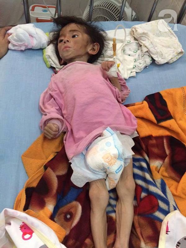 Sau hơn 3 tháng được mẹ nuôi chăm sóc, bé gái 14 tháng tuổi nặng 3,5kg giờ ra sao? Sau hơn 3 tháng được mẹ nuôi chăm sóc, bé gái 14 tháng tuổi nặng 3,5kg giờ ra sao?