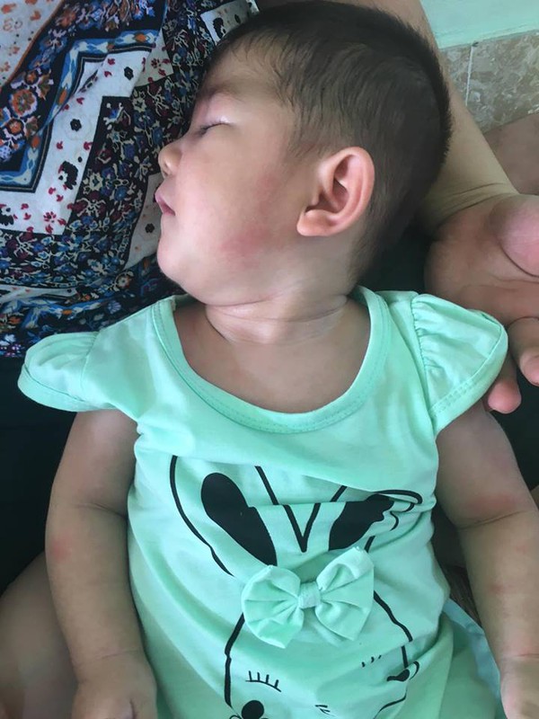 Sau hơn 3 tháng được mẹ nuôi chăm sóc, bé gái 14 tháng tuổi nặng 3,5kg giờ ra sao? Sau hơn 3 tháng được mẹ nuôi chăm sóc, bé gái 14 tháng tuổi nặng 3,5kg giờ ra sao?