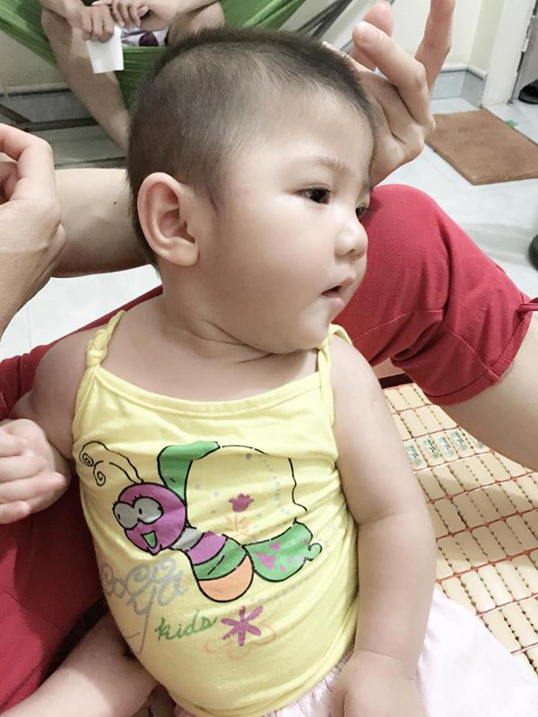 Sau hơn 3 tháng được mẹ nuôi chăm sóc, bé gái 14 tháng tuổi nặng 3,5kg giờ ra sao? Sau hơn 3 tháng được mẹ nuôi chăm sóc, bé gái 14 tháng tuổi nặng 3,5kg giờ ra sao?