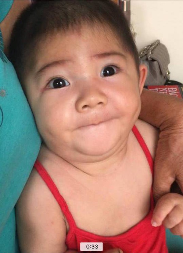 Sau hơn 3 tháng được mẹ nuôi chăm sóc, bé gái 14 tháng tuổi nặng 3,5kg giờ ra sao? Sau hơn 3 tháng được mẹ nuôi chăm sóc, bé gái 14 tháng tuổi nặng 3,5kg giờ ra sao?