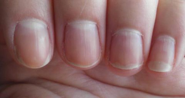 How to maintain a healthy color of the nail bed - wide 5