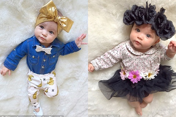 b&eacute; g&aacute;i