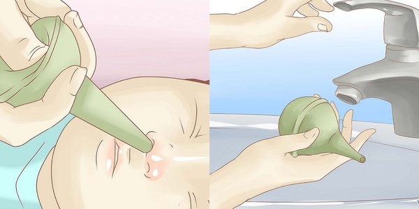 Cách chuẩn giúp mẹ vệ sinh mũi và nhỏ thuốc mũi cho con 3