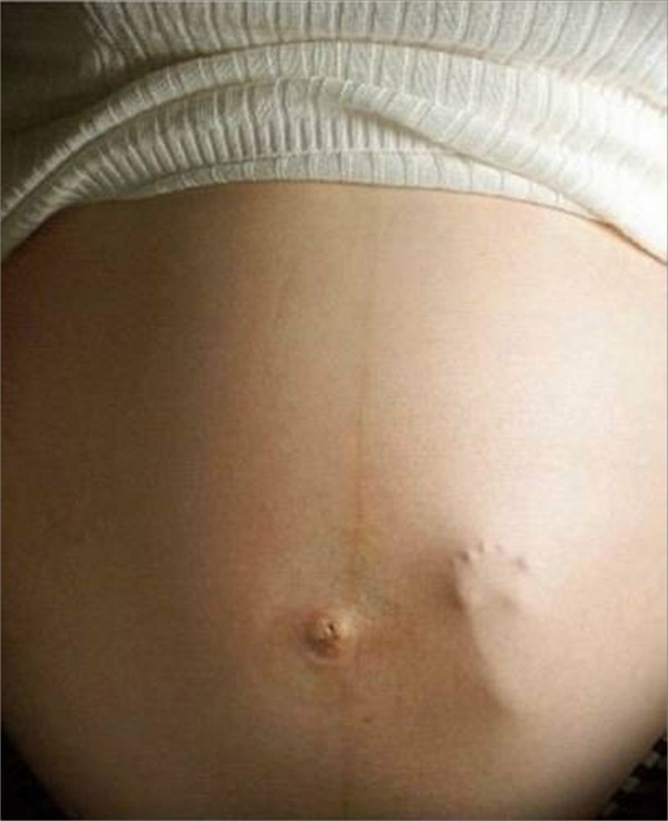 Chuyển động của thai nhi 1
