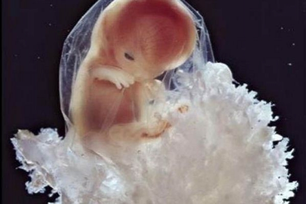 Sự lớn lên kì diệu của bào thai trong bụng mẹ 17