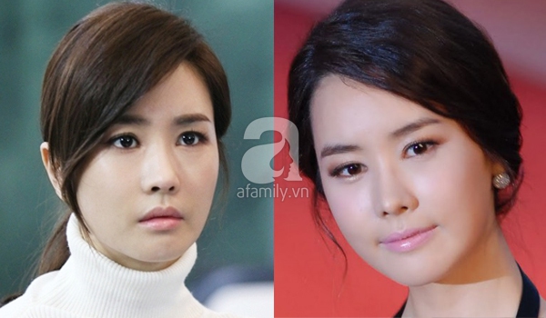 Những kiều nữ Hàn bị biến dạng do phẫu thuật thẩm mỹ 20 Những kiều nữ Hàn bị biến dạng do phẫu thuật thẩm mỹ 20