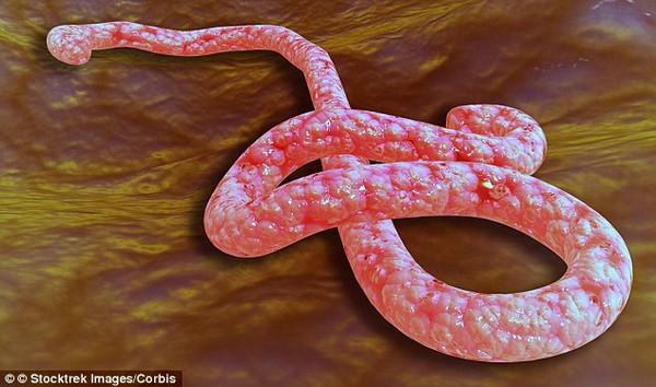 Mỹ cách ly hai bệnh nhân nghi nhiễm Ebola  2