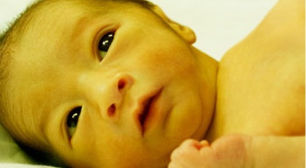 Suy giáp bẩm sinh ở trẻ: không phát hiện sớm, nguy hiểm khó lường 1