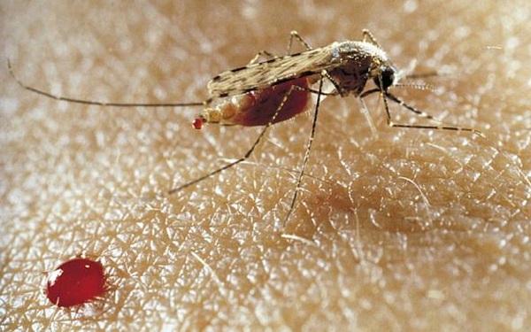 dịch bệnh zika