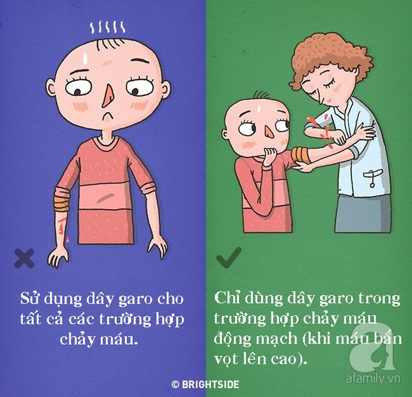 Sơ cứu Sơ cứu